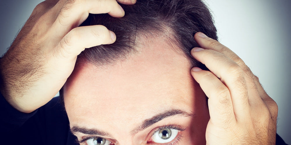 5 Ways to Help Get Rid of Dandruff
