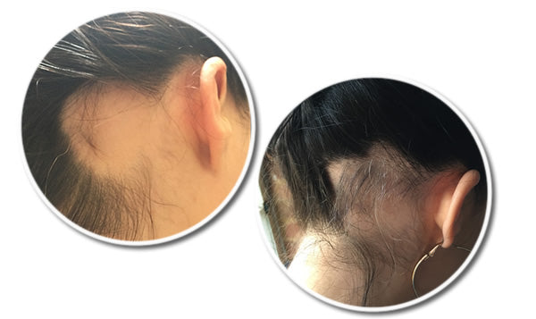 Reseed R12 Tri Peptide Hair Growth Serum for Women 30 ml R12 Tri Peptide Hair Growth Serum for Women 30 ml - Reseed Hair Loss Range for Men and Women,  Reseed Hair Loss Range ,Hydrolysed Lupine Protein, DHT Blocker, Peptides, Anageline, Aloe barbadensis leaf Juice